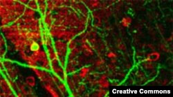 Нейрон центральной нервной системы мыши, подсвечен зеленым флуоресцирующим белком.